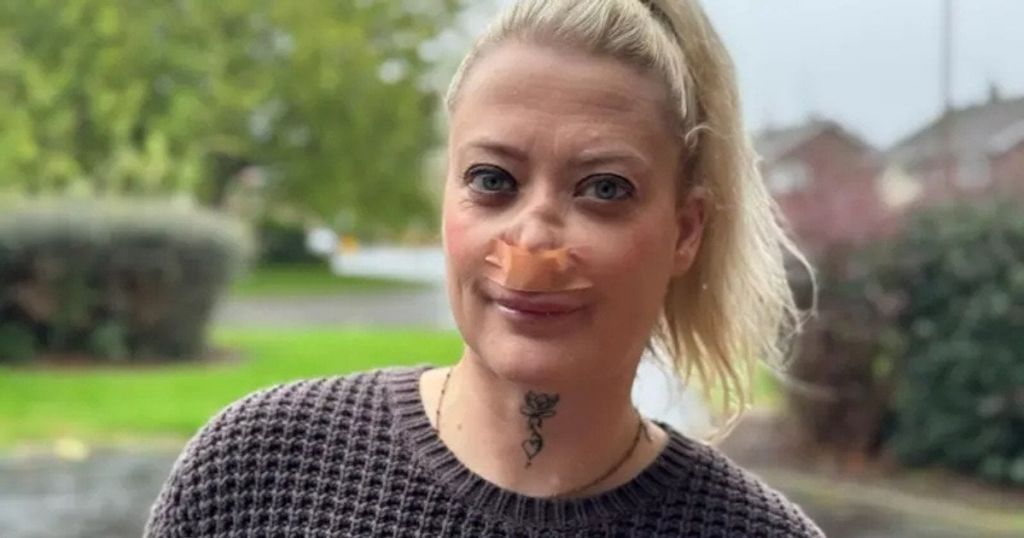 Лікування зубів у Туреччині обернулося для британки щоденними стражданнями Лікування зубів у Туреччині обернулося для британки щоденними стражданнями