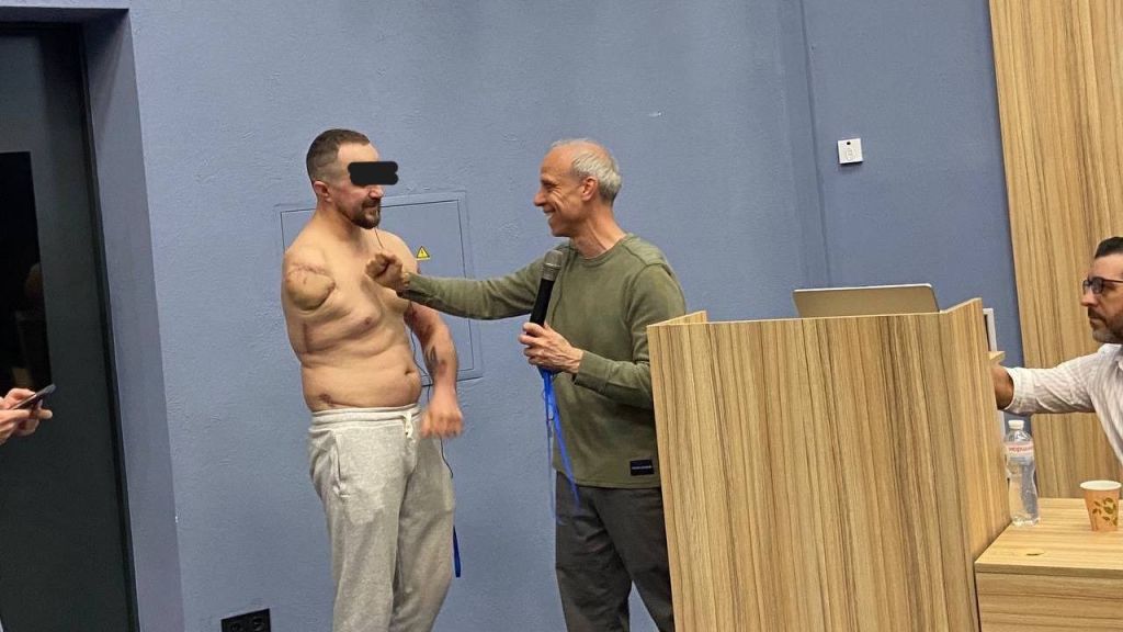 Ботокс проти фантомного болю – українські вчені зробили відкриття Ботокс проти фантомного болю – українські вчені зробили відкриття