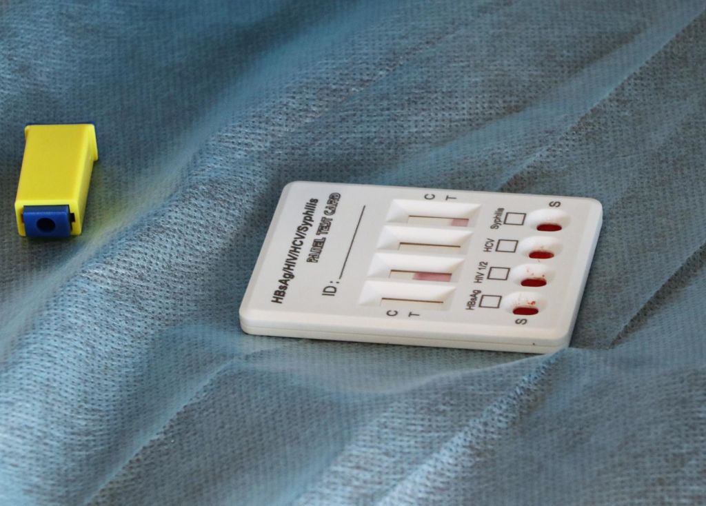 Одеситів забезпечують безоплатним тестуванням на ВІЛ у міських медзакладах Одеситів забезпечують безоплатним тестуванням на ВІЛ у міських медзакладах