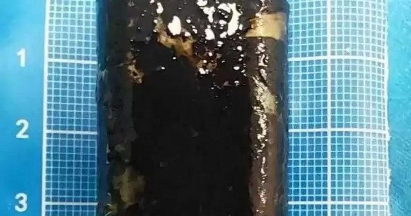 Вона все ще працювала: чоловік прожив 30 років із запальничкою у шлунку Вона все ще працювала: чоловік прожив 30 років із запальничкою у шлунку