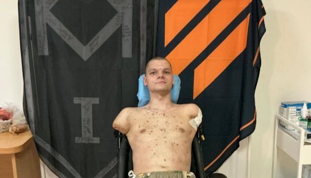 У Києві військовому з ампутаціями відмовили у банківській картці, глава НБУ обіцяє доставити її особисто У Києві військовому з ампутаціями відмовили у банківській картці, глава НБУ обіцяє доставити її особисто