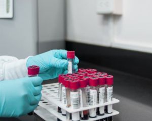 Вірус міг мутувати: спалах Еболи перевищив 4 тис. хворих Вірус міг мутувати: спалах Еболи перевищив 4 тис. хворих