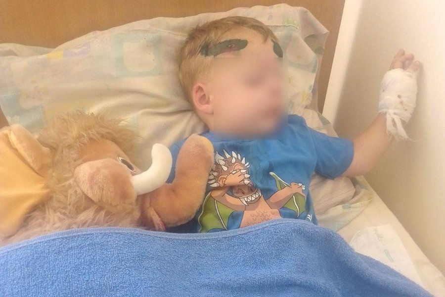 Батько дворічного хлопця, якого автівкою збив співробітник ТЦК, розповів обставини інциденту та про стан дитини Батько дворічного хлопця, якого автівкою збив співробітник ТЦК, розповів обставини інциденту та про стан дитини