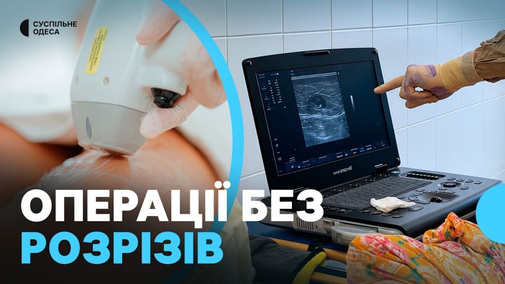 «Хворі одразу встають»: в Ізмаїлі впровадили лазерні операції на венах без розрізів (відео) «Хворі одразу встають»: в Ізмаїлі впровадили лазерні операції на венах без розрізів (відео)